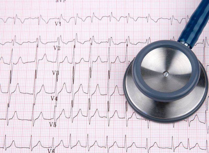 اختبار رسم القلب ECG مع سماعة الطبيب'