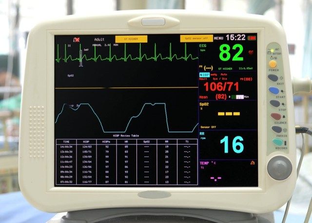 جهاز مراقبة معدل ضربات القلب'