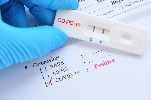 نتيجة اختبار إيجابية باستخدام جهاز اختبار سريع لـ COVID-19 ، فيروس كورونا الجديد 2019'