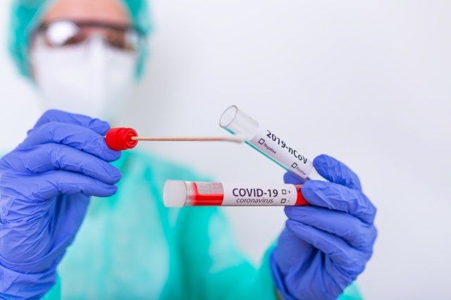 ممرضة تحمل أنبوب اختبار بالدم لتحليل 2019-nCoV. فحص الدم لفيروس كورونا الجديد'