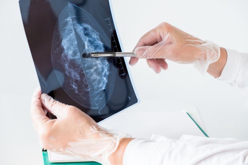 طبيبة تحلل نتائج التصوير الشعاعي للثدي بالأشعة السينية.'