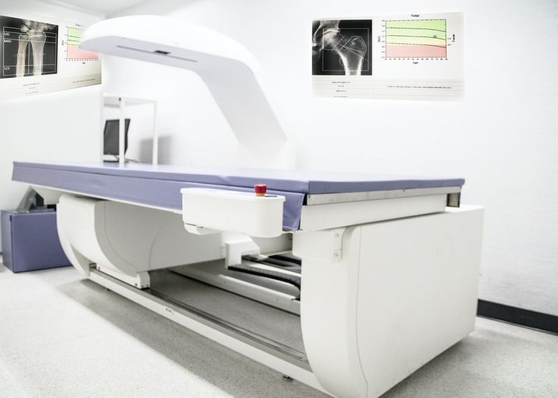 عن قرب آلة كثافة العظام ، قسم الأشعة السينية في المستشفى المستخدمة لتشخيص أعراض هشاشة العظام'
